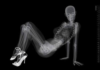 X-ray Pin-up Calendar